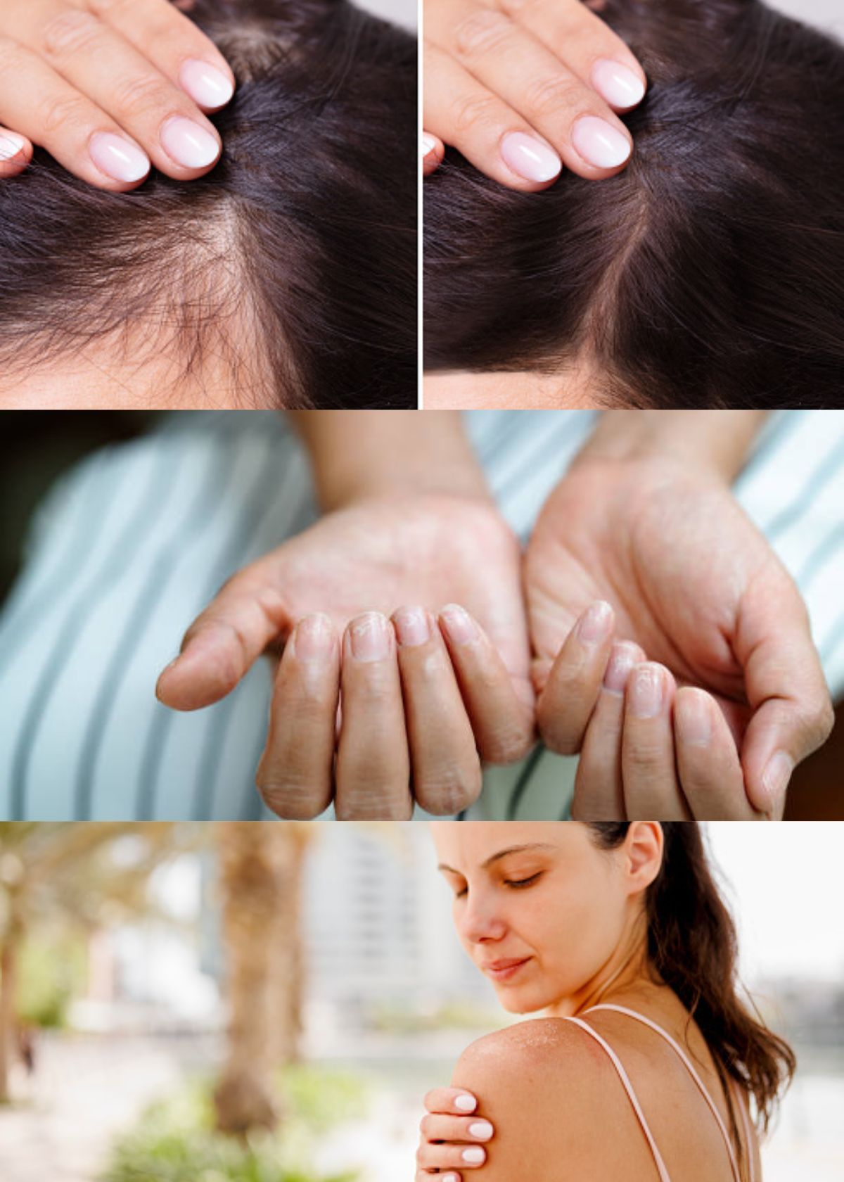 5 Best Biotin Supplements For  Hair Growth, Nail, & Skin Health!